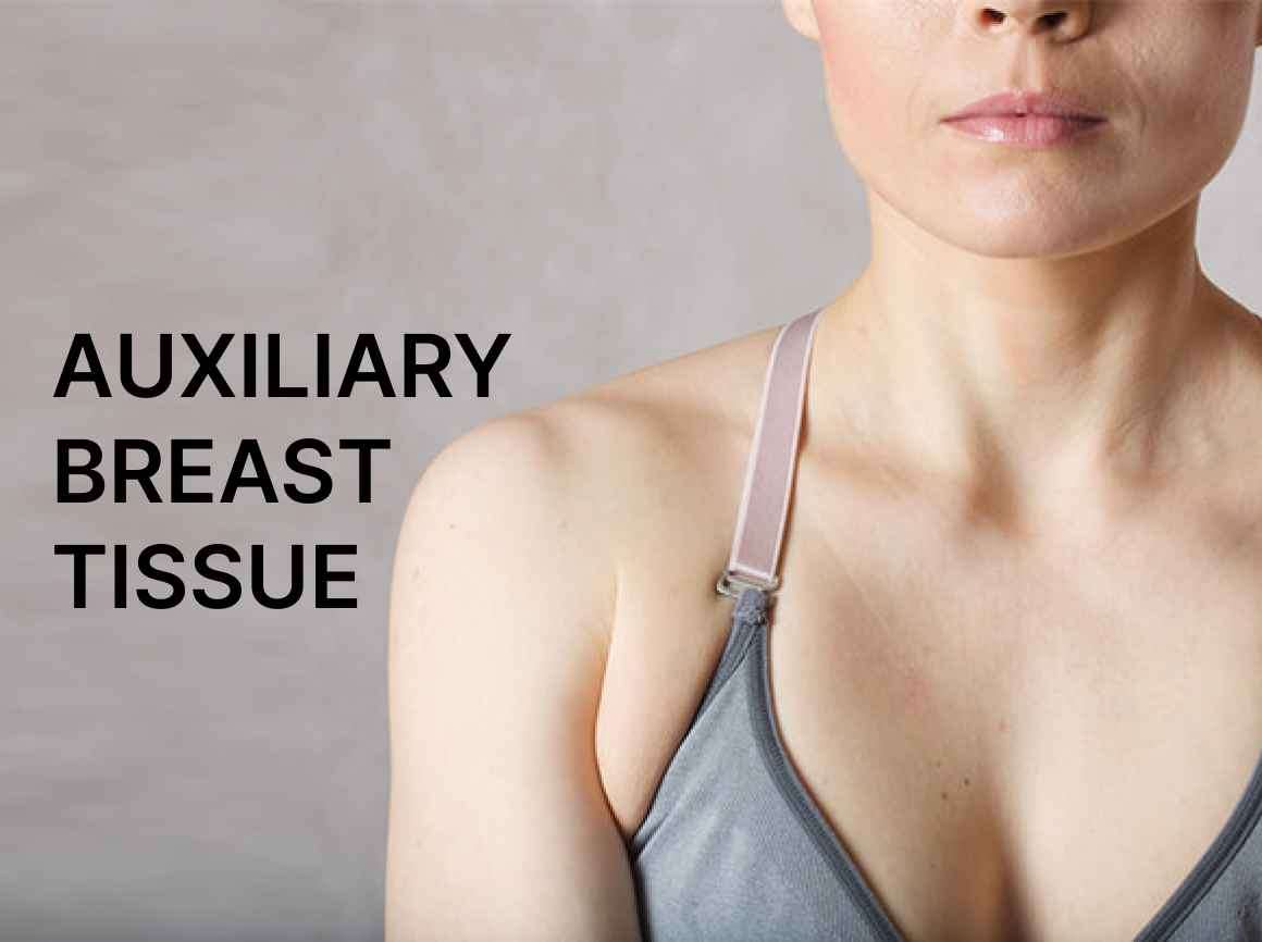 Asymmetrical, Tubular and Accessory Breasts - Kauvery Hospital